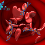 Antiphospholipid syndrome: When your blood turns against you and time becomes critical