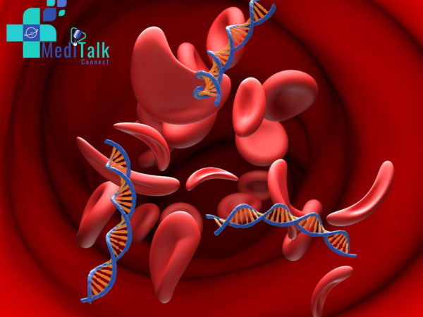 Antiphospholipid syndrome: When your blood turns against you and time becomes critical